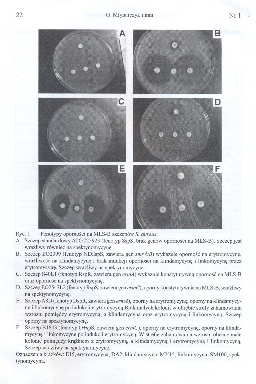 22 G. Mlynarczyk i inni Nr l : Ryc. 1 Fenotypy opornosci na MLS-B szczepów S. aureus: A. Szczep standardowy ATCC25923 (fenotyp SspS, brak genów opornosci na MLS-B).
