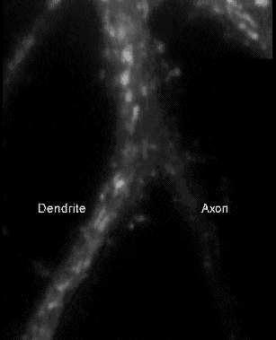 akson Neurofilamenty pełnią funkcję podporową Neurotubule, współpracując z mechanoenzymami,