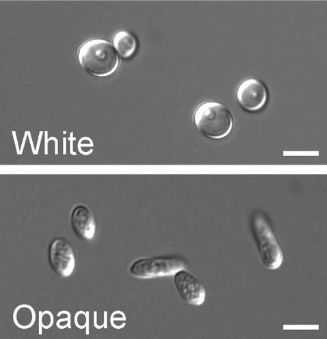 Saccharomycetes (drożdże pączkujące,