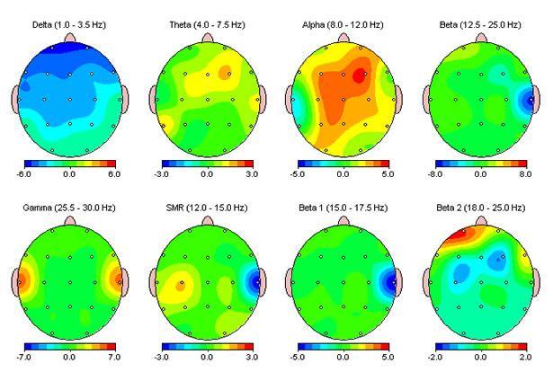 Processing and analysis of the EEG