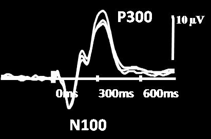 P300 based BCI