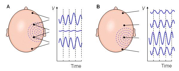 Measurement of the EEG signals 6 Bipolar (A) and unipolar (B) measurement Source: http://www.bem.