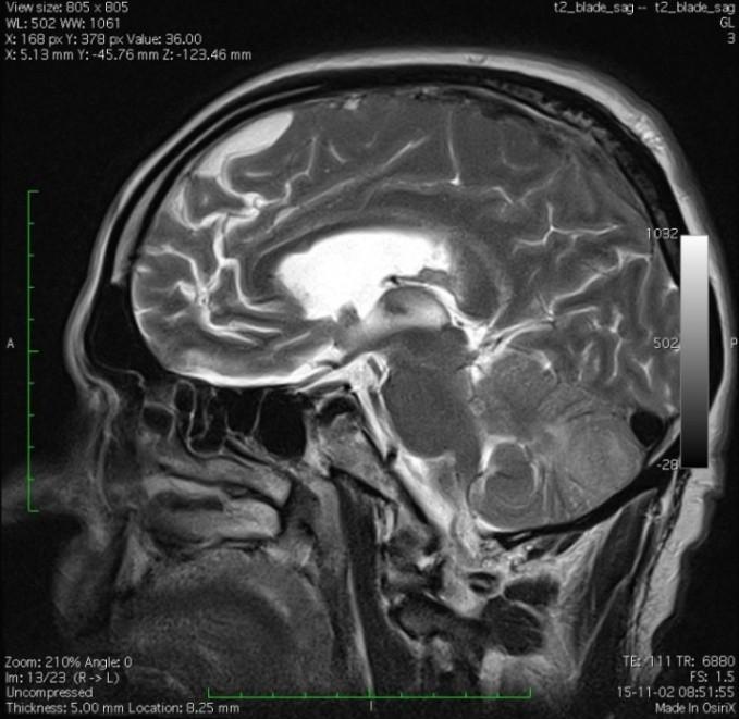 Weronika Sikora, Marlena Kot, Monika Klimek, Andrzej Fidor chicznie. Pacjent został skierowany do Kliniki Neurologii Samodzielnego Publicznego Szpitala Klinicznego nr 4 w Lublinie.