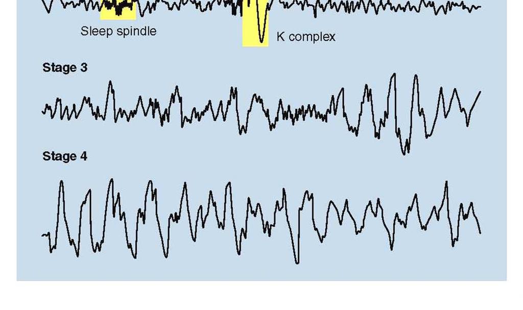 przy zamkniętych oczach, stan odprężenia (okolice potyliczne i czołowe) rytmy theta (4-8 Hz) rytm systemu limbicznego (hipokamp)