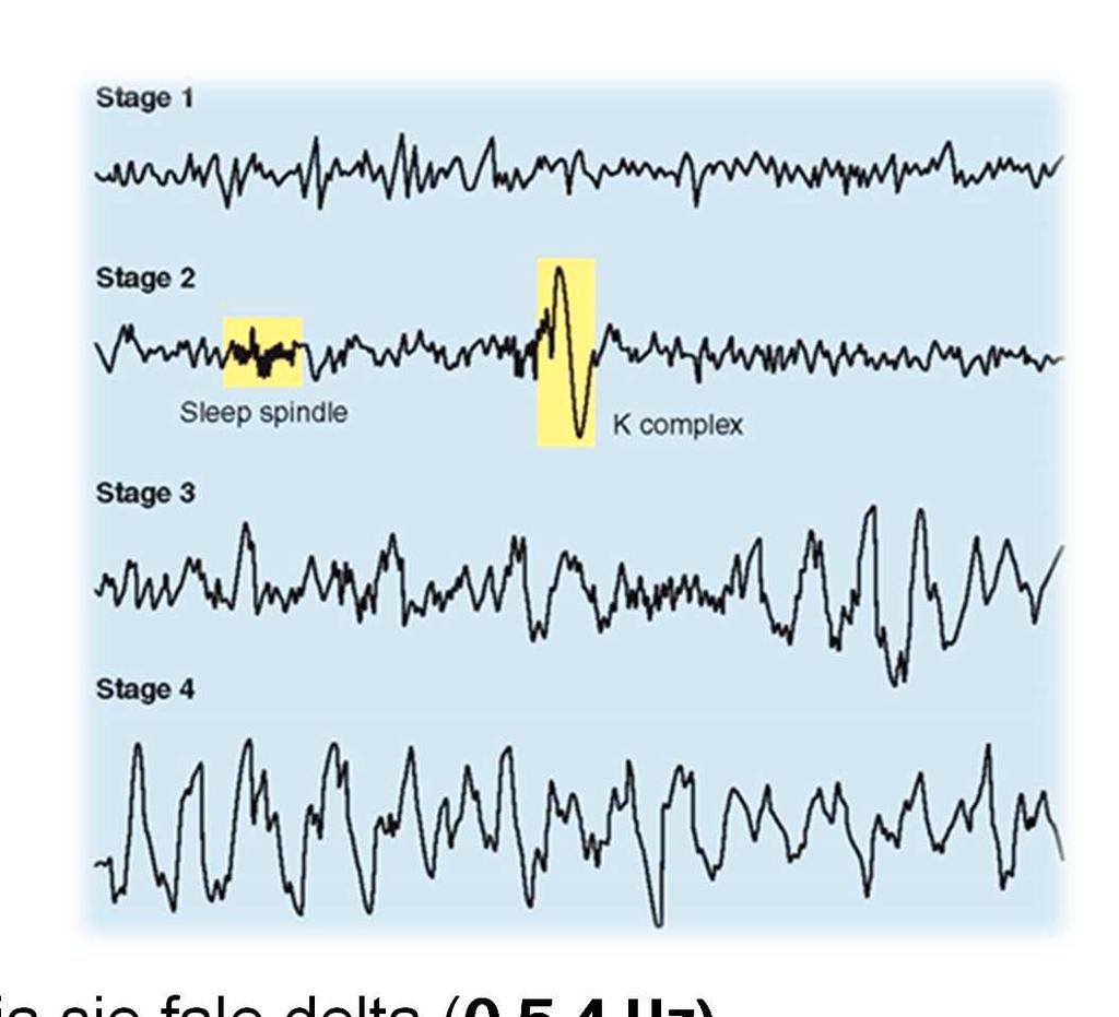 NREM Faza 1 - to faza przejściowa pomiędzy czuwaniem a snem, manifestuje się między innymi zanikiem częstotliwości alfa występują tu stany hipnagogiczne, czy mioklonie przysenne Faza 2 fale theta