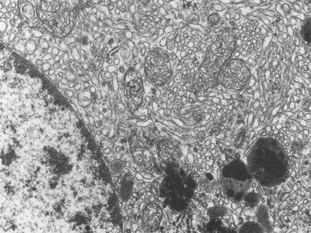 ziarnisto-luteinowe ciałka żółtego komórki