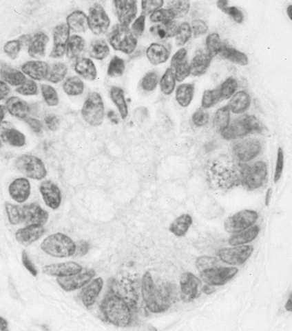 pinealocyty) komórki C (tarczyca) komórki główne (przytarczyce) komórki A, B, D, PP (wysepki trzustkowe)