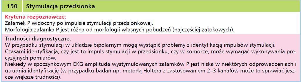 Podstawy oceny stymulatorów przedsionkowych