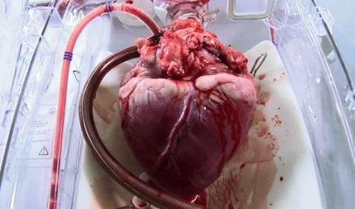 Temat: Choroby i higiena układu krwionośnego. Serce jest najbardziej niezawodną i wydajną pompą, jaką znamy. Wykonuje wręcz morderczą pracę.