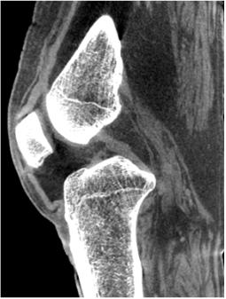 Rysunek ten przedstawia obrazy zarówno kości, jak i tkanek miękkich uchwycone podczas badań wykonywanych z użyciem badanego aparatu CBCT firmy Carestream.