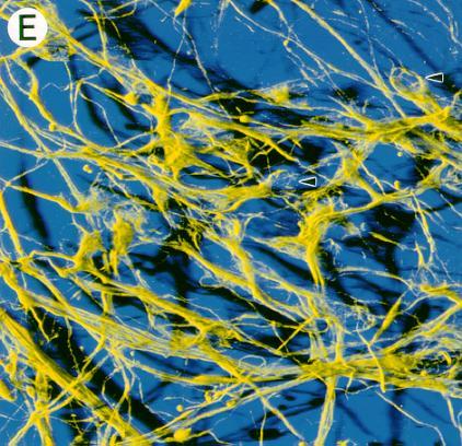 Embrionalne komórki macierzyste (in vitro) Embrionalne komórki