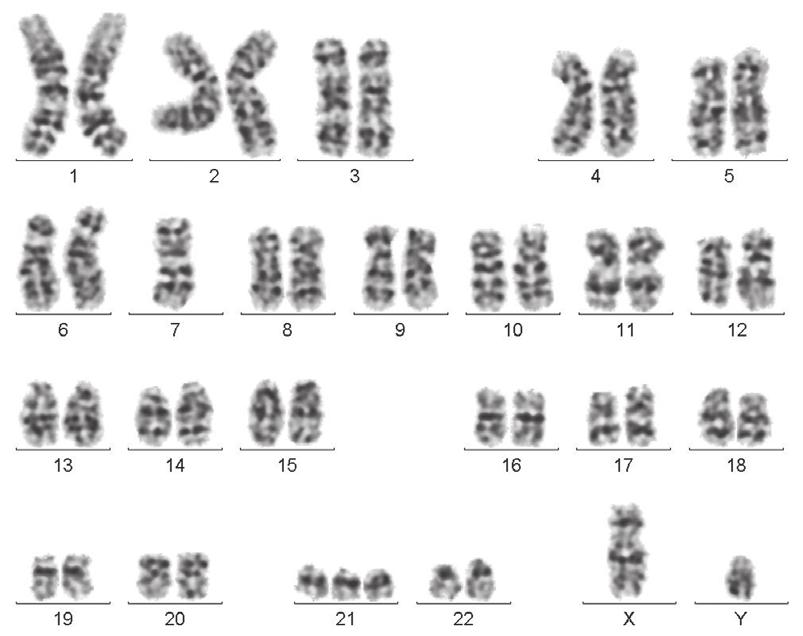 Hematologia 2011, tom 2, nr 3 Rycina 2.