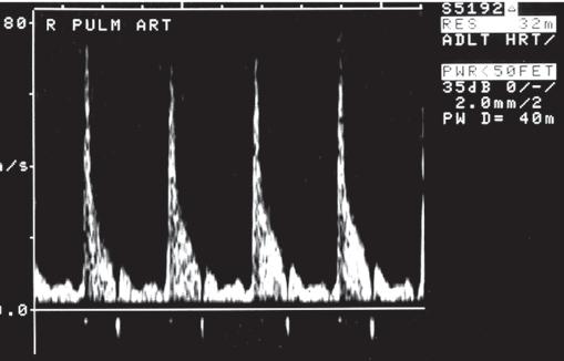ressure 1 mm, an increase o systolic blood ressure o mm and diastolic blood ressure o 1 mm above t e basic values aminations were re eated in some cases, but results rom t e last e amination be ore