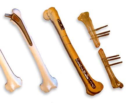 MATERIAŁY METALICZNE