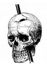 Przypadek Phineasa Gage Phineas Gage, mistrz strzałowy, miał w 1848 roku wypadek