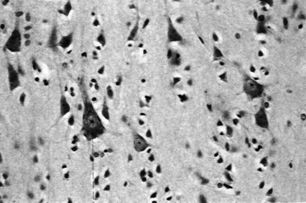 podstawne) pobudliwość przewodnictwo Komórka nerwowa: ciało komórkowe (perykarion)