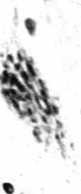 gruszkowata Komórka nerwowa Organelle: tigroid aparat Golgiego mitochondria lizosomy