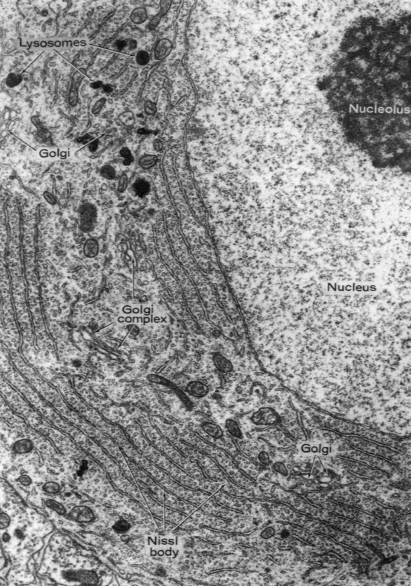 Mikroskop elektronowy ujawnia, Ŝe tigroid to skupiska szorstkiej siateczki śródplazmatycznej i wolnych rybosomów W komórce nerwowej