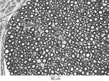 mielinowej grubości aksonu Typy włókien nerwowych: A: grube