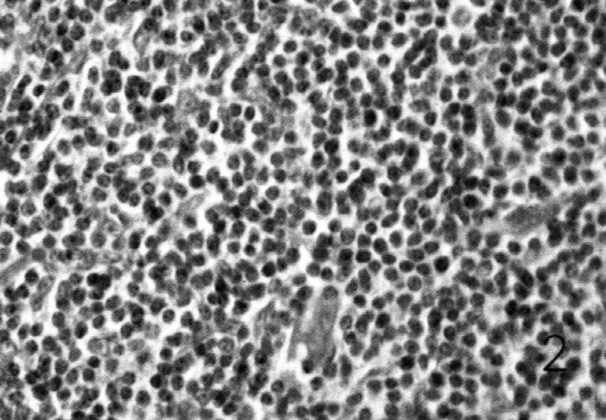 limfocyty pamięci Limfocyty B kooperując z limfocytami T H namnaŝają się i przekształcają w komórki plazmatyczne.