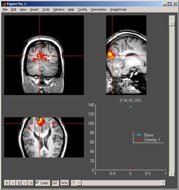 e) Image Processing Toolbox