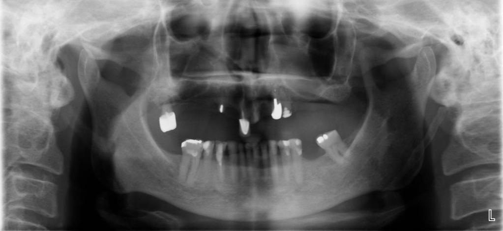 - - - - - Assessment of suitability of orthopantomographs in dental diagnostics of... J Stoma 2012; 65, 6 Fig. 1.