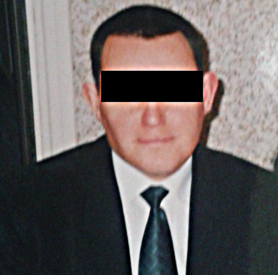 Aleksandra Piątek, Elżbieta Skowrońska- Jóźwiak, Dagmara Bukarewicz, Andrzej Lewiński Wstęp Akromegalia występuje z częstością 40 70 przypadków na milion osób.