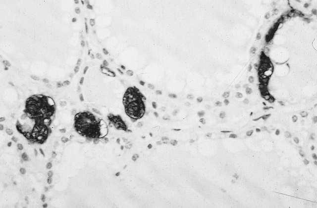 komórki główne (przytarczyce) komórki A, B, D, PP (wysepki trzustkowe) komórki chromochłonne (rdzeń