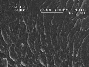454 Jolanta JANIK Rys. 3. SEM PBT40% /LDPE 60% /AC10%: a) x300, b) x2000 Fig. 3. SEM PBT40% /LDPE 60% /AC10%: a) x300, b) x2000 Rys. 4.