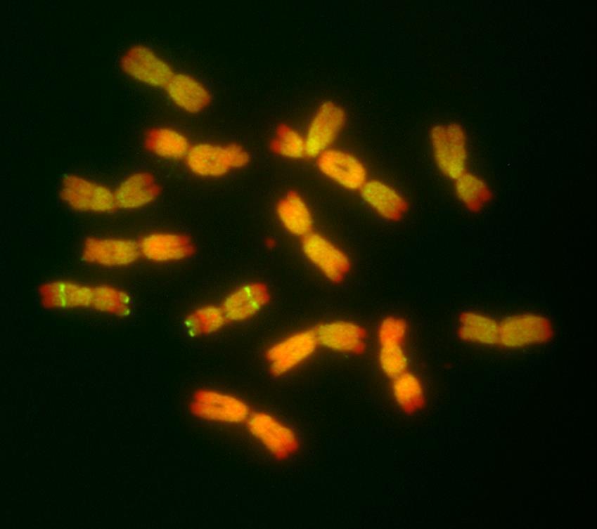 Chromosom