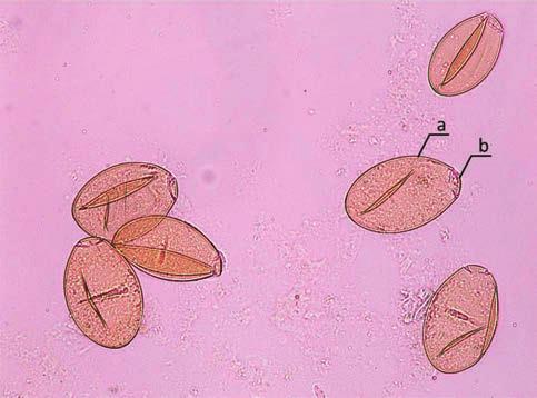 Fasciola hepatica Fasciola hepatica Linnaeus, 1758 Motylica wątrobowa ZASIĘG GEOGRAFICZNY Kosmopolityczna przywra, występująca głównie w krajach rozwijających się (zwłaszcza wschodnia Azja i