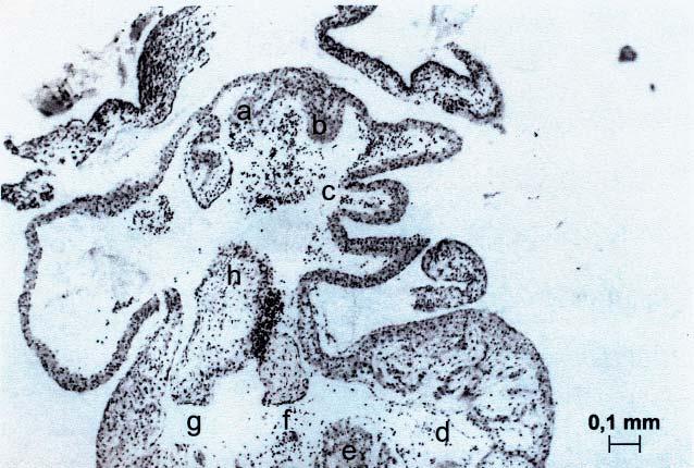 prawa komora, h poduszeczka wsierdziowa. Figure 2.