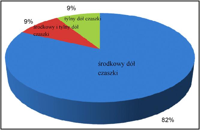 350 [(Ryc._1)TD$FIG] otolaryngologia polska 66 (2012) 348 352 [(Ryc._2)TD$FIG] Ryc.