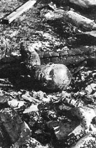131. Spopielone zwłoki więźnia w niemieckim obozie koncentracyjnym. 1945 Mówi Maryla Michałowska: Kiedy przyjechałam do Brzezinki, zaprowadzono nas do bloku nr 15, gdzie przebywało około 1000 kobiet.