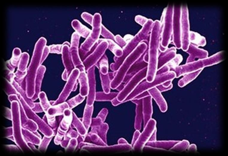 GRUŹLICA Gruźlica jest chorobą zakaźną wywołaną przez bakterię - prątki należące do