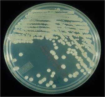 Diagnostyka molekularna Inżynieria genetyczna II Metody analizy w