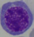 nebeska brak Proerytroblast 0-5 µm okrągły, rzadko owalny okrągłe cemna, grubogrudkowa czasem