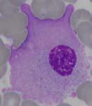 granatowa, nekedy pojedyncze wodnczk brak Megakarocyt do 00 µm owalny,