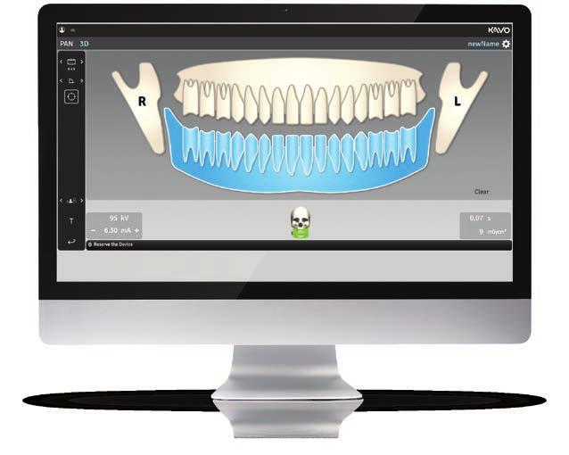 Stworzony do działania Każda funkcja tomografu OP 3D została zaprojektowana z myślą o usprawnieniu pracy w gabinecie.