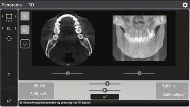 Narzędzia dla profesjonalistów SMARTVIEW 2.0 nowy wymiar kontroli i elastyczności Dzięki OP 3D można łatwo i dokładnie kontrolować lokalizację pola obrazowania.