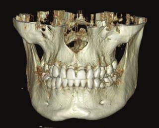 Programy dopasowane do potrzeb klinicznych Aby sprostać potrzebom praktyk o szerokim zakresie usług, OP 3D oferuje protokoły standardowe, pediatryczne i panoramiczne z segmentacją, boczne projekcje