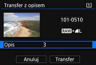 Podłącz aparat do serwera FTP wcześniej (str. 75). W karcie [32] wybierz pozycję [Transfer obrazów], a następnie naciśnij przycisk <0>.