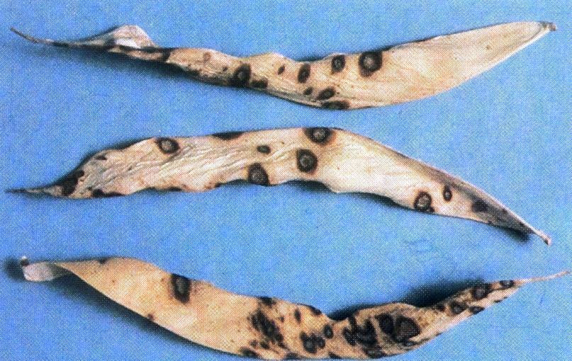 Antraknoza