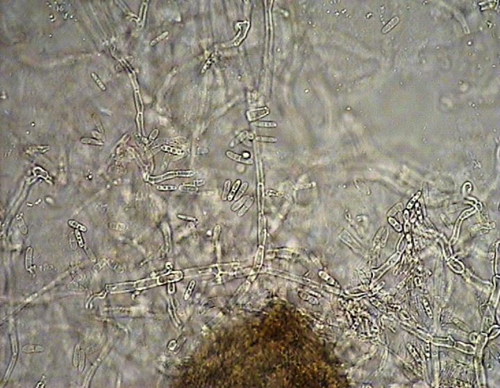Ascochyta pisi fragment piknidium