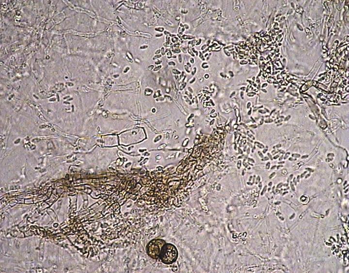 Ascochyta pinodes podłużne