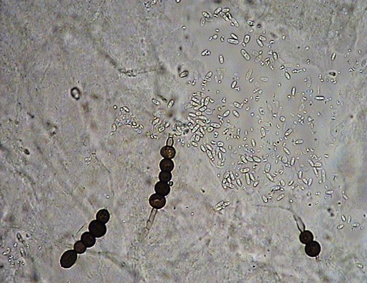 Phoma pinodella piknospory