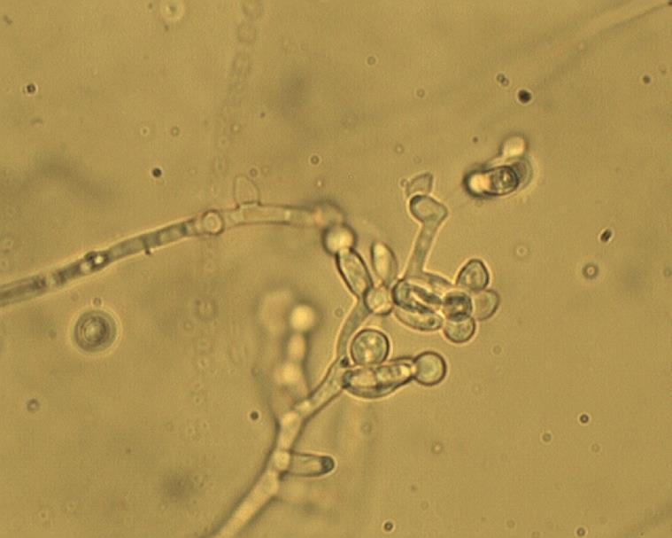 F. poae F.