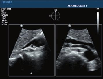 Zastosowana tu technologia pozwala uzyskać dwa razy więcej danych klinicznych w tym samym czasie, zapewniając szybsze i pewniejsze rozpoznanie.