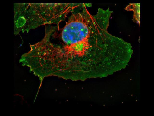 GFP