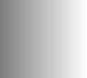 / ORIGINAL PAPERS Endokrynologia Polska / Polish Journal of Endocrinology Tom/Volume 5; Numer/Number 5/5 ISSN 2-X Makroprolaktyna u osób z hiperprolaktynemią: Obserwacje kliniczne i relacje pomiędzy